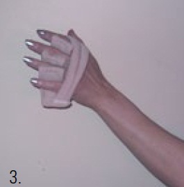 DermaSaver Finger Seperator